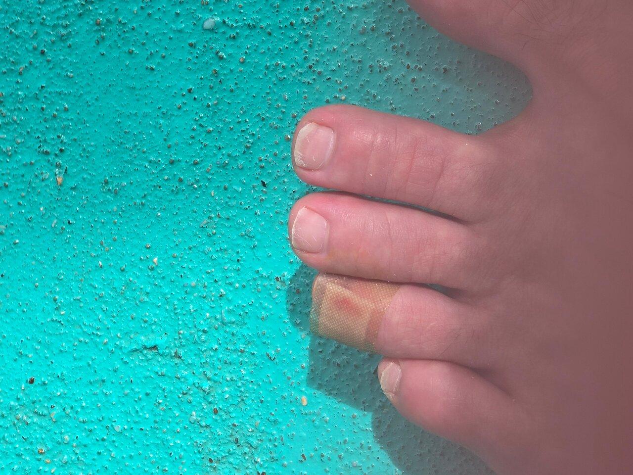 Review photo