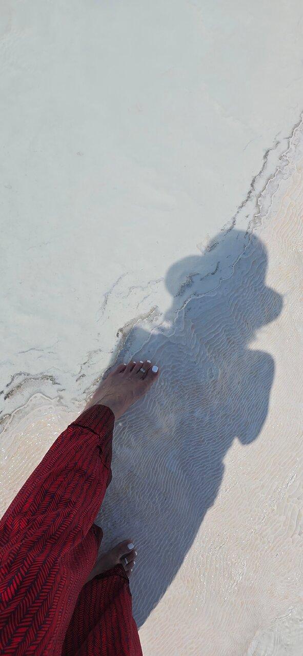 Review photo